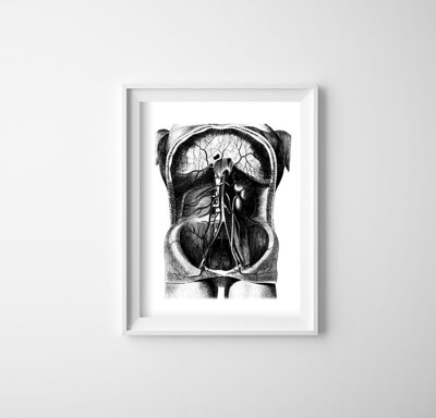 Plakat für den Frieden Skelett Illustration
