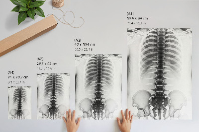 Bilder poster Röntgenaufnahme